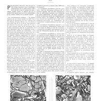 0925 - Page 921 - Travaux originaux. Goitre lingual et hypothyroïdie. Par MM. P. Sainton, G. Ardoin et P. Frankfurt...