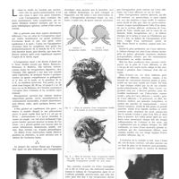 0927 - Page 923 - Travaux originaux. L'invagination des anses dans la bouche de gastro-entérostomie. Par MM. René-A. Gutmann et Pierre Jobin...
