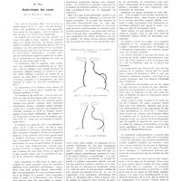 1023 - Page 997 - Petites cliniques de «la presse médicale». N° 414. Anévrisme du coeur. Par G. Poix et G. Thoyer