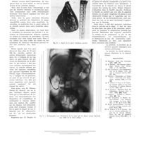 1048 - Page 1022 - Travaux originaux. Les hémocholécystes. Par MM. Noël Fiessinger, André Bergeret et Jacques Leveuf / Bibliographie