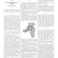 1087 - Page 1061 - Petites cliniques de «la presse médicale». N° 415. Fracture latente du col de fémur. Par Louis Ramond...