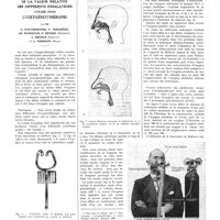 1093 - Page 1067 - Travaux originaux. De la valeur relative des différents inhalateurs utilisés pour l'oxygénothérapie. Par MM. L. Dautrebande, F. Nogarède, Ed. Dumoulin, G. Hensel..., J. Orémus... et L. Pierquin...
