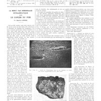 1111 - Page 1085 - Travaux originaux. L'induction organisatrice et le problème du cancer. Par J. Jolly... Bibliographie / La mort par hémorragie intrahépatique dans le cancer du foie. Par Maurice Loeper