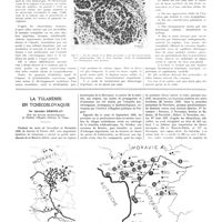 1112 - Page 1086 - Travaux originaux. La mort par hémorragie intrahépatique dans le cancer du foie. Par Maurice Loeper / La tularémie en Tchécoslovaquie. Par Jaroslav Drrohlav...