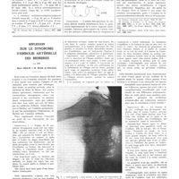 1399 - Page 1373 - Travaux originaux. La toxi-infection gonococcique expérimentale et son traitement chimiothérapie. Par MM. C. Levaditi et A. Vaisman / Réflexion sur le syndrome d'embolie artérielle des membres. Par MM. Marc Iselin et R. Heim de Balsac