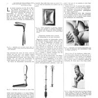 1417 - Page 1391 - Travaux originaux. Historique des hémorroïdes. Par R. Bensaude