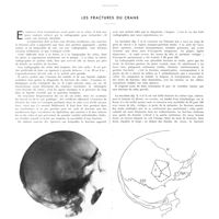 1427 - Page 1401 - Travaux originaux. La radiologie du praticien. Par MM. J. Belot et L. Nahan. Les fractures du crâne