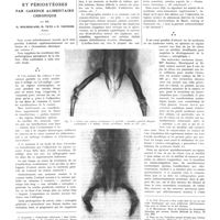 1445 - Page 1419 - Travaux originaux. Ostéoses et périostéoses par carence alimentaire chronique. Par MM. G. Mouriquand, H. Tete et P. Viennois...