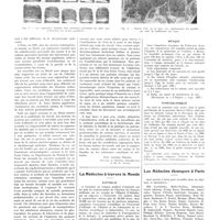 1562 - Page 1536 - Chroniques, variétés et informations. Les altérations des empreintes digitales chez les travailleurs et leur traitement / La médecine à travers le monde. Australie / Mexique / Tchécoslovaquie / Les médecins étrangers à Paris