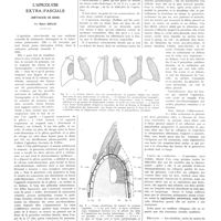 1565 - Page 1539 - Travaux originaux. L'apicolyse extra-fasciale (méthode de Semb). Par Marc Iselin