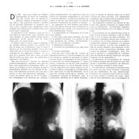 1588 - Page 1562 - Travaux originaux. Résultats des recherches effectuées sur les blocages viscéraux en vue d'une exploration radiologique. Par MM. E. L. Lanari, M. E. Jorg et J. A. Aguirre