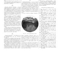 1598 - Page 1572 - Travaux originaux. Pachyonychie congénitale avec kératodermie et kératoses disséminées de la peu et des muqueuses (Syndrome de Jadassohn et Lewandowski). Par A. Touraine... / Bibliographie des principaux travaux