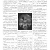 1604 - Page 1578 - Travaux originaux. Étude des modifications pneumographiques des tumeurs des ventricules latéraux. Par Harden Askenasy / Bibliographie