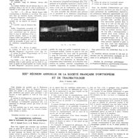 1635 - Page 1609 - Travaux originaux. Agents chimiques de l'excitation nerveuse dans les dysfonctions végétatives. Par MM. D. E. Alpern et P. D. Tzomaya / XIXe réunion annuelle de la société française d'orthopédie et de traumatologie (Paris, 8 octobre 1937) / Première question mise à l'ordre du jour. Les transplantations tendineuses dans le traitement des pieds bots paralytiques