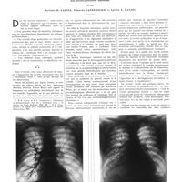 1761 - Page 1735 - Travaux originaux. Le rôle du facteur bronchique chez les «cardiaques noirs» d'Ayerza (Les broncho-pulmonaires cyanotiques). Par MM. Mariano R. Castex, Eduardo Capdehourat et Egidio S. Mazzei