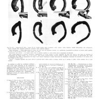 1778 - Page 1752 - Travaux originaux. Étude anatomo-radiologique des courbures de l'aorte thoracique. Par R. Heim de Balsac... / Bibliographie
