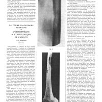 1914 - Page 1888 - Travaux originaux. Comptes rendus des recherches sur l'encéphalite épidémique au Japon. Le virus de l'encéphalite épidémique. Par Ryokichi Ianada... / La forme diaphysaire primitive de l'ostéomyélite à staphylocoque de l'adulte. Par P. Moiroud...