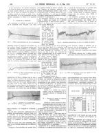 Fig. 5. Réflexe psycho-galvanique pris chez un parkinsonien / Fig. 6. Abolition du réflexe psycho-ga [...]