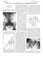 Fig. 1. Radiographie à la fin du cinquième mois de la grossesse / Fig. 3. Décalque des trois surface [...]