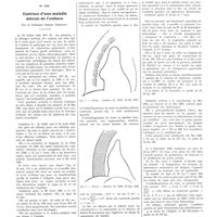 1327 - Page 1323 - Petites cliniques de «La Presse médicale». N° 585. Guérison d'une maladie mitrale de l'enfance. Par le Professeur Pierre Nobécourt