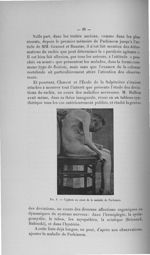 Fig. 8. Cyphose au cours de la maladie de Parkinson - Exposé des travaux scientifiques. Décembre 190 [...]