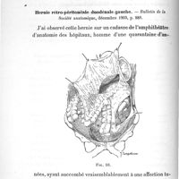 0026 - Page 26 - Travaux scientifiques. V. Hernies