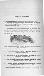 Fig. 36. Face postérieure de la trompe. Rupture de grossesse isthmique dans le premier mois - Titres [...]