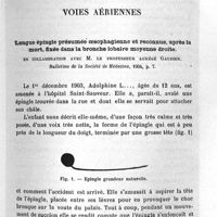 0033 - Page 33 - Travaux scientifiques. Voies aériennes