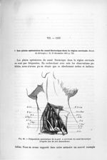 Fig. 62. Préparation anatomique de la port n cervicale du canal thoracique (d'après une de nos disse [...]