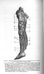 Fig. 141. Photographie d'une dissection d'un membre variqueux sur lequel on avait fait une résection [...]