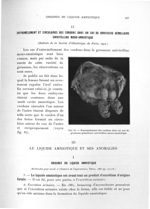 Fig. 67. Entremèlement des cordons dans un cas de grossesse gémellaire univitelline mono-amniotique  [...]