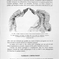0218 - Page 205 - Anatomie pathologique spéciale. I Appareil respiratoire. Varices / Vaisseaux lymphatiques
