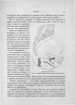 Fig. 5. Coupe du cadavre d'une femme de dix-neuf ans - Exposé des travaux scientifiques