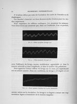 Fig. 8. Chien atropinisé. Lavage à 40° / Fig. 9. Chien atropinisé. Lavage à 27° / Fig. 10. Tracé pen [...]