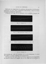 Fig. 11. Lavage à 27° / Fig. 12. Chien chloroformé. Lavage à 19° / Fig. 13. Lavage à 50°, suivant im [...]