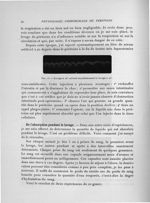 Fig. 15. Lavage à 26° suivant immédiatement le lavage à 40° - Exposé des travaux scientifiques