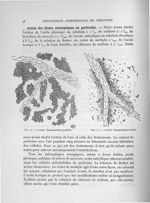 Fig. 20. 4e stade : Desquamation partielle / Fig. 21. 4e stade : Desquamation totale - Exposé des tr [...]