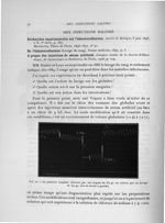 Fig. 22. La pression sanguine abaissée par une saignée de 850 gr. est relevée par un lavage de 500 g [...]