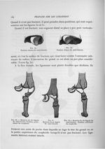 Fig. 54. Position externe du semi-lunaire / Fig. 55. Position interne du semi-lunaire / Fig. 56. Rot [...]