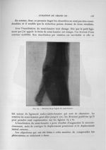 Fig. 59. Rotation de 90 degrés du semi-lunaire - Exposé des travaux scientifiques