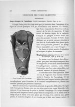 Fig. 74. Corps étranger dans l'oesophage - Exposé des travaux scientifiques