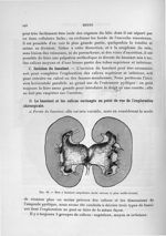 Fig. 88. Rein à bassinet ampullaire fendu suivant le plan médio-frontal - Exposé des travaux scienti [...]