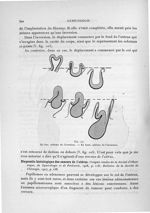 Fig. 105. En bas, schéma de l'éversion. - En haut, schéma de l'inversion - Exposé des travaux scient [...]