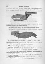 Fig. 111. Carpus curvus vu par le bord radial / Fig. 112. Carpus curvus vu par le bord cubital - Exp [...]