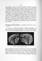 Fig. 78. Grossesse interstitielle (S. Pozzi) - Notice sur les travaux scientifiques