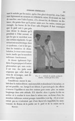 Fig. 15. Attitude du malade pendant la marche, soutenu par deux aides - Exposé des travaux scientifi [...]