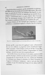 Fig. 18. Attitude du malade sur le dos faisant effort pour se mettre sur son séant - Exposé des trav [...]