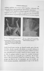 Fig. 19. Catalepsie cérébelleuse. Pose de 15 secondes/ Fig. 20. Ataraxie. Pose de 15 secondes - Expo [...]