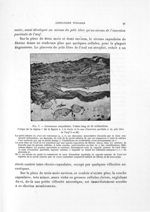 Fig. 7. Grossesse ampullaire. Foetus long de 35 millimètres - Titres et travaux scientifiques