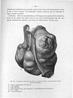 Fig. 69. Volumineux chondrome des côtes, vu d'avant en arrière, après dissection (vache) - Titres et [...]